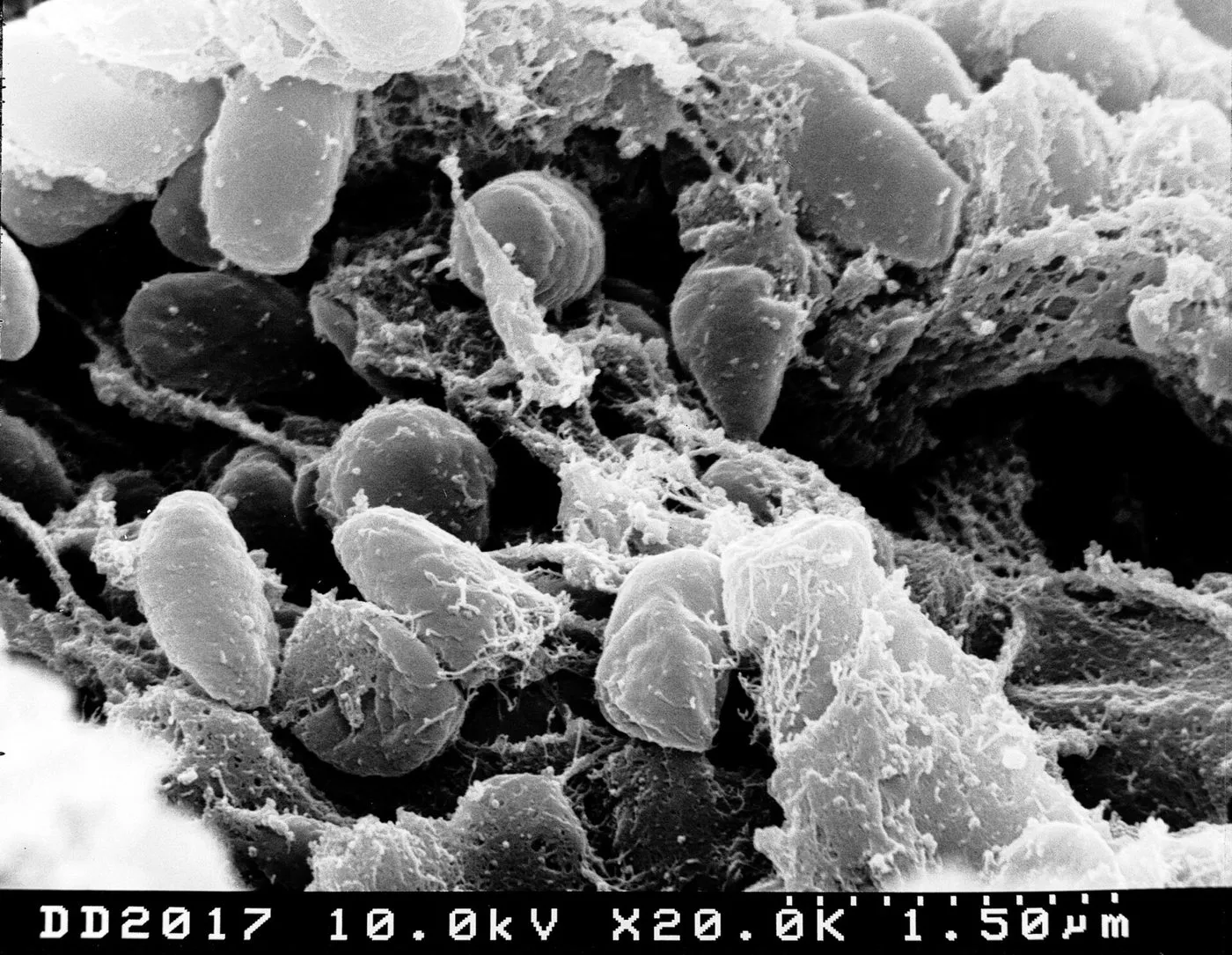 Micrograph: Yersinia pestis inside a flea. Scanning electron micrograph · NIAID